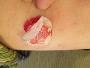 Gross, I know. Fifth time is the charm, right?